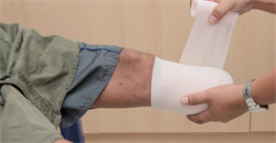 Working with Expert Witnesses in Serious Injury