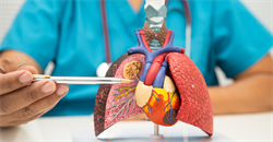 Mesothelioma or lung cancer?