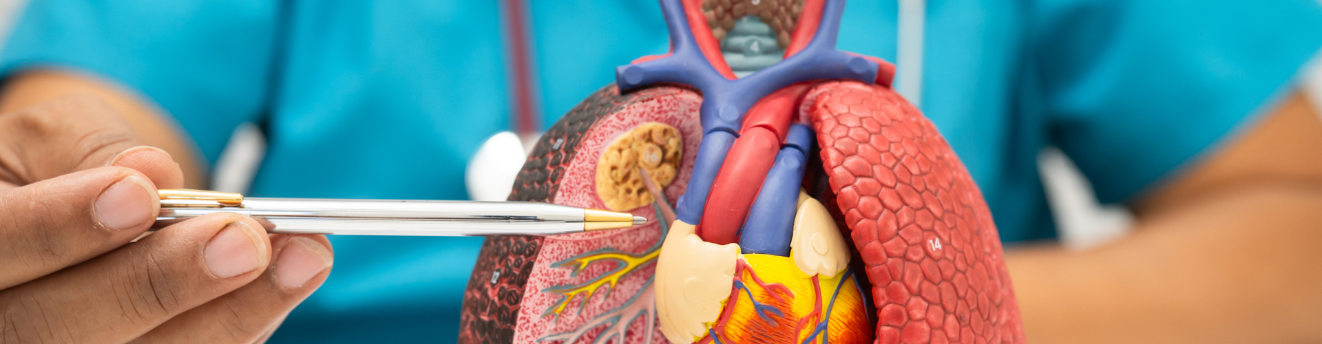 Mesothelioma or lung cancer?
