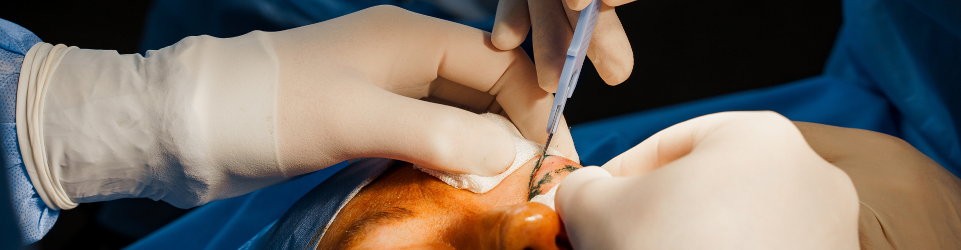 A Day in the Life of a Plastic, Aesthetic and Hair transplant Surgeon and Expert Witness