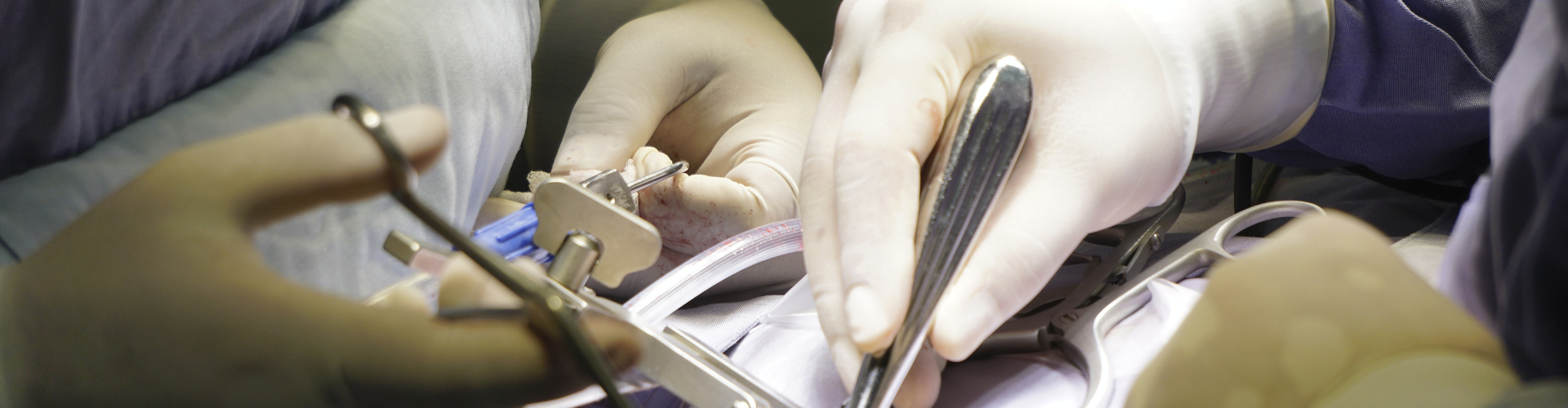 A Day in the Life of an Orthopaedic Spinal Expert Witness